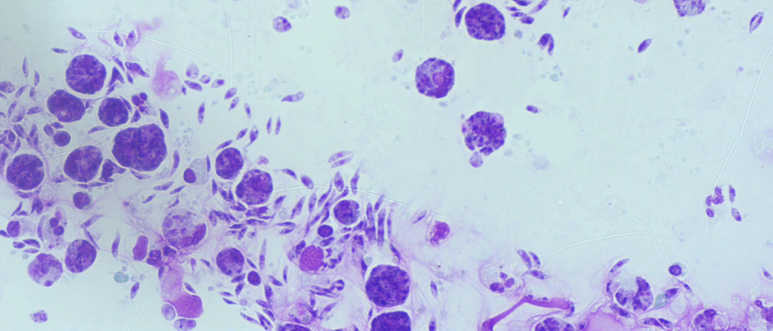 Leishmania paraziták képeket - Leishmaniasis tünetei és kezelése - HáziPatika
